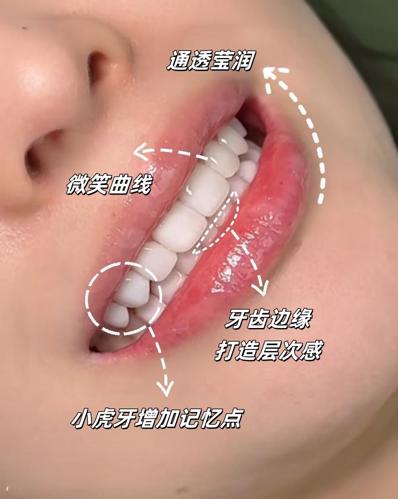 🔥被嘲笑的露龈笑，如今竟成高级感密码？
