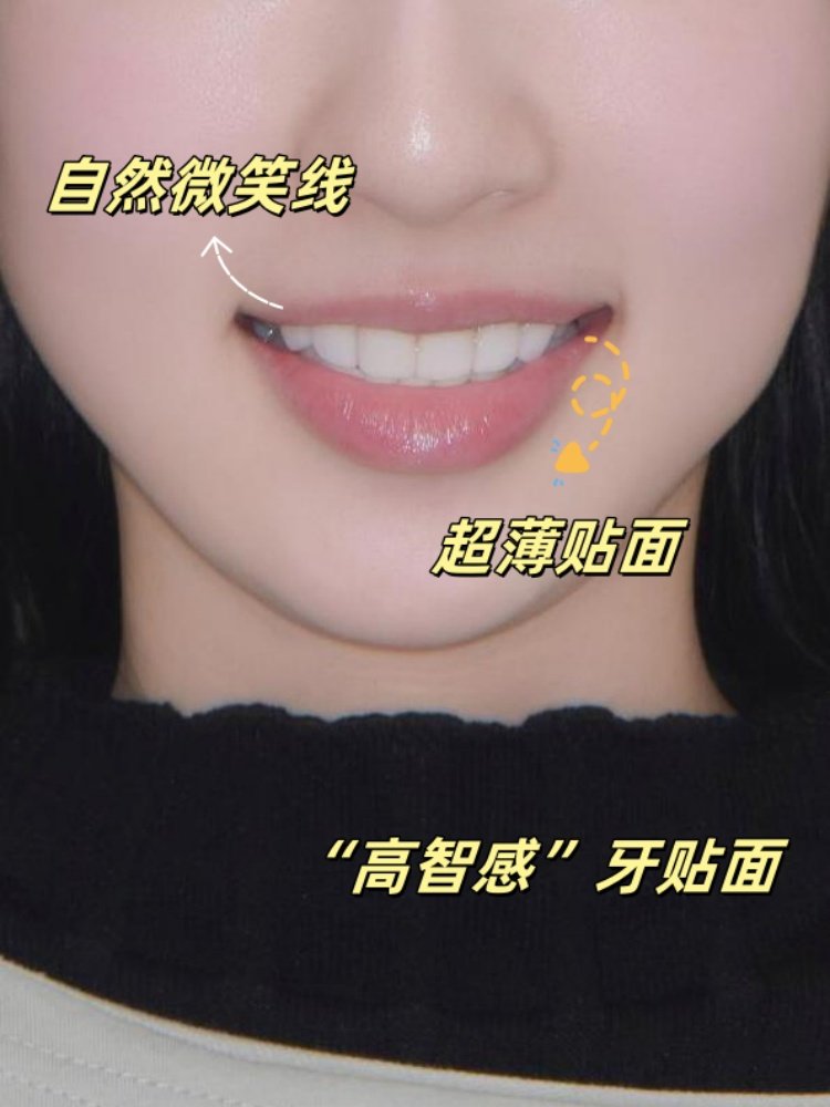 😣23岁黄牙女孩的贴面逆袭：从&ldquo;咖啡牙&rdquo;到&ldquo;妈生白&rdquo;全记录