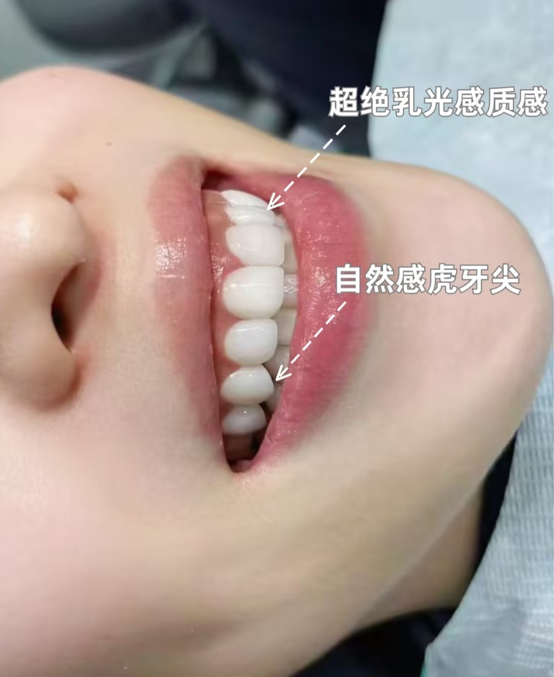 【超绝乳光感虎牙妆】素颜也能get女团同款心机小尖牙！🦷