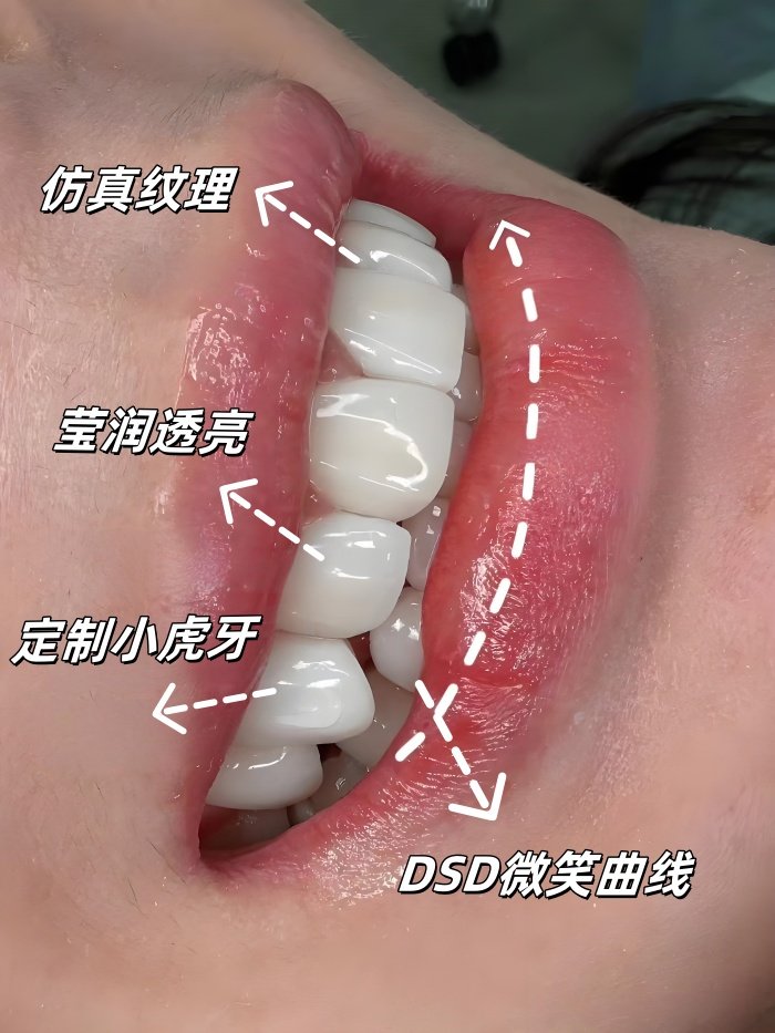 ✨牙齿亮一度 颜值开挂术｜从抿嘴笑到露齿笑的逆袭秘籍✨