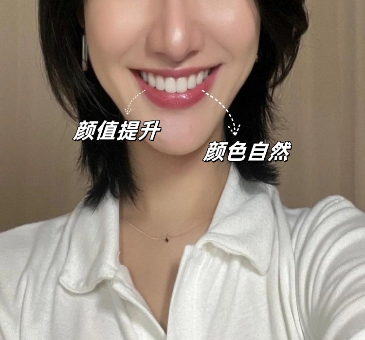 29岁的逆袭：5年贴面经验大公开！