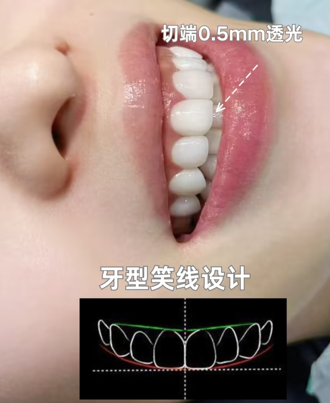 【超绝乳光感虎牙妆】素颜也能get女团同款心机小尖牙！🦷案例图片 2
