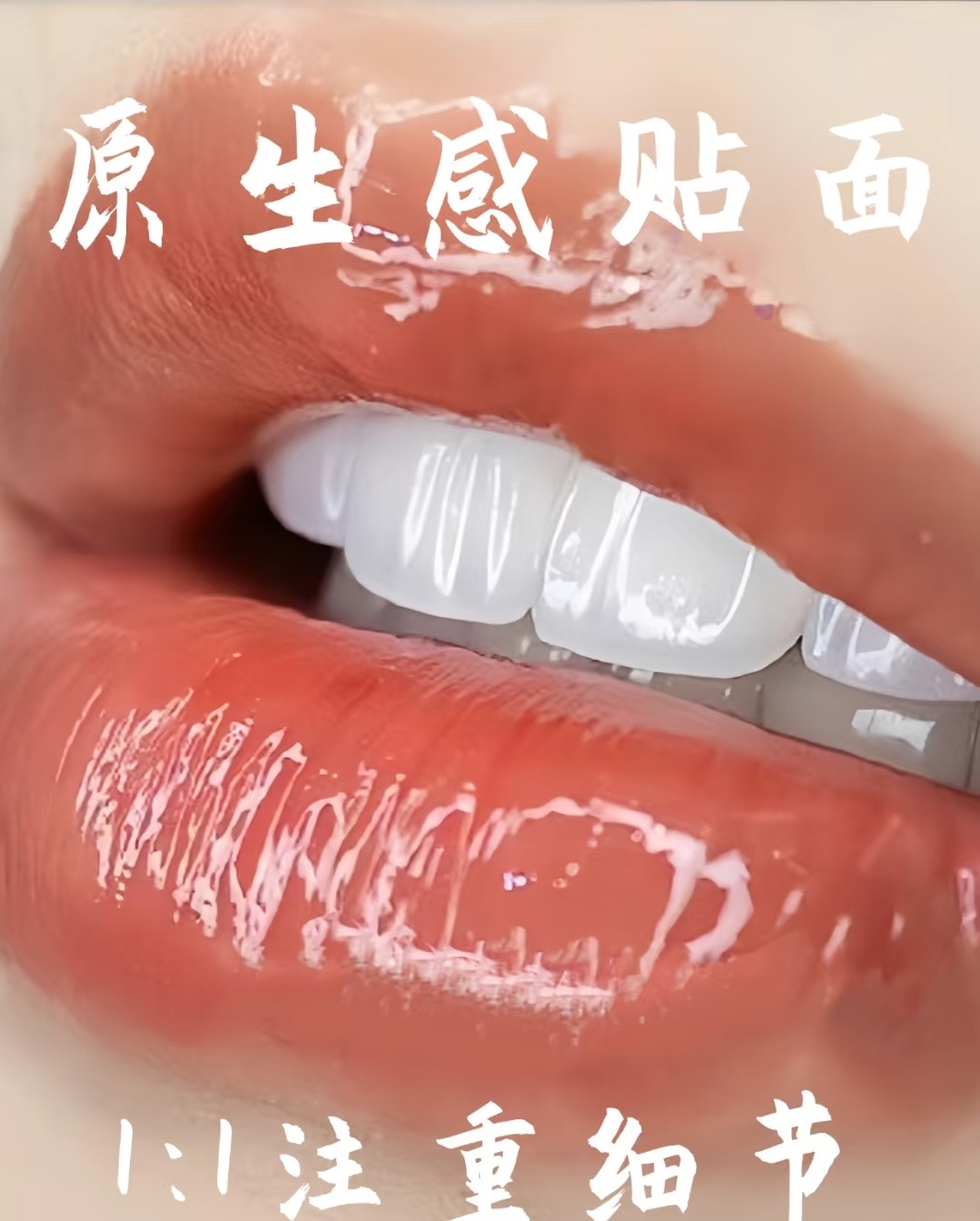 🌟【瞬间拥有明星同款微笑牙贴面】拯救大黄牙、缺损牙！💎案例图片 2