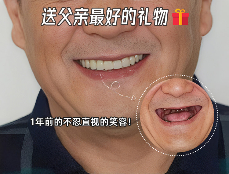 🦷陪父亲种牙全记录｜从抗拒到真香，这个决定我们做对了！案例图片 1