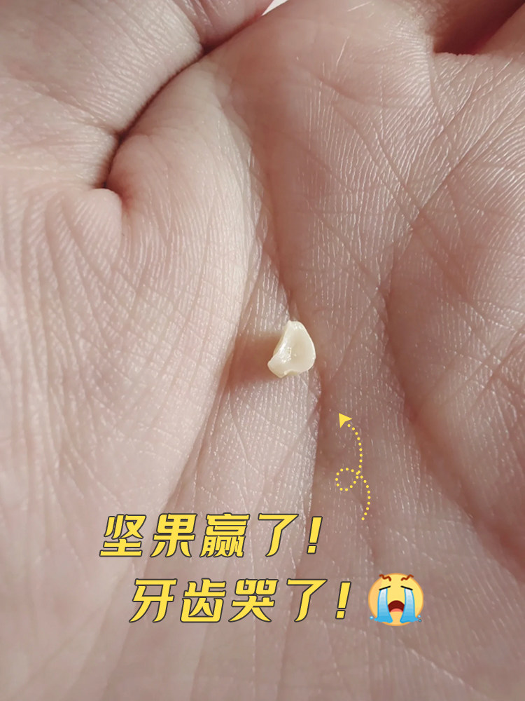 拖延症患者含泪总结：补牙真的越早越好！我的血泪史+避坑指南