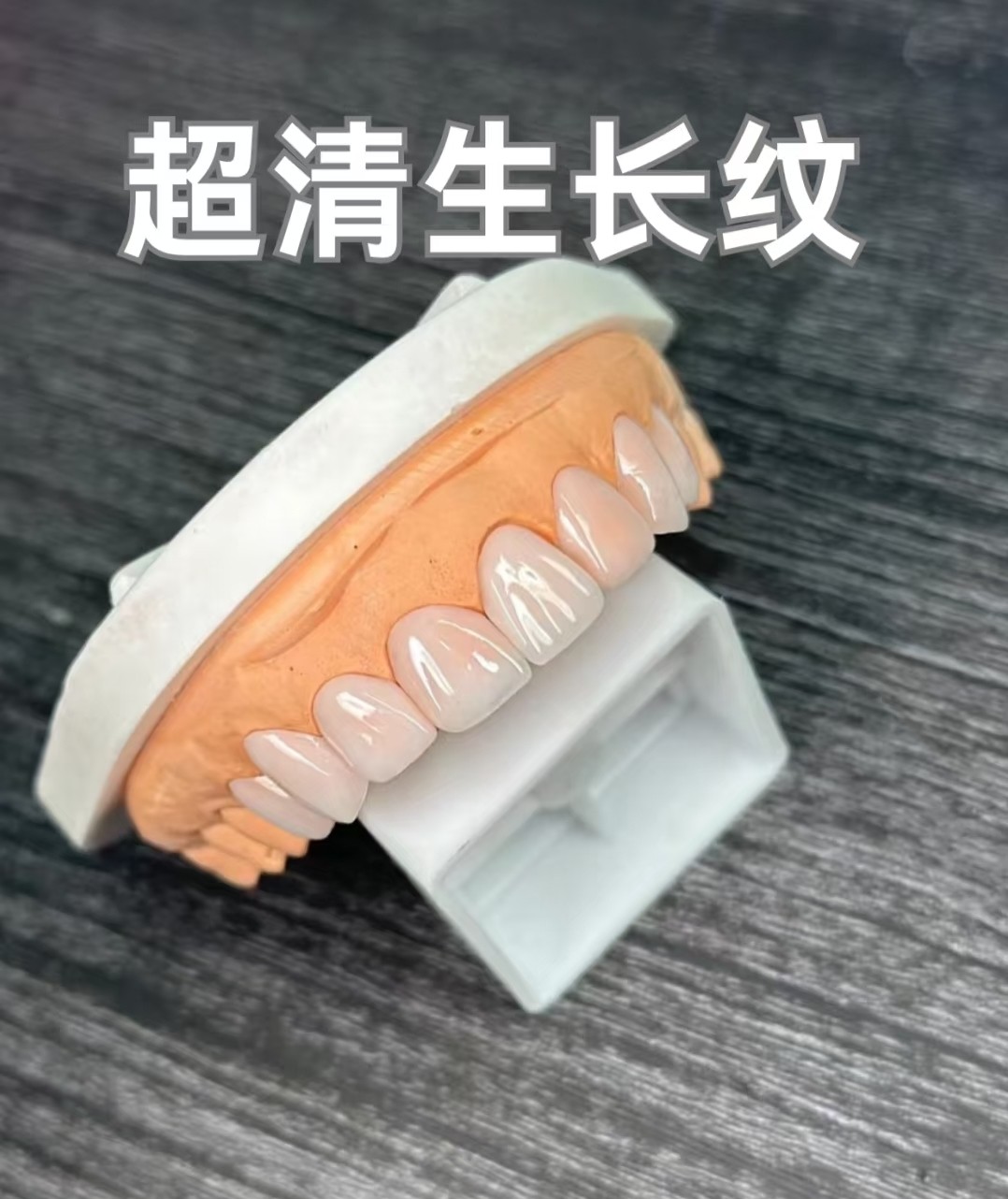 🍬我的牙齿美白贴面改造日记｜细节分享+真实效果案例图片 2