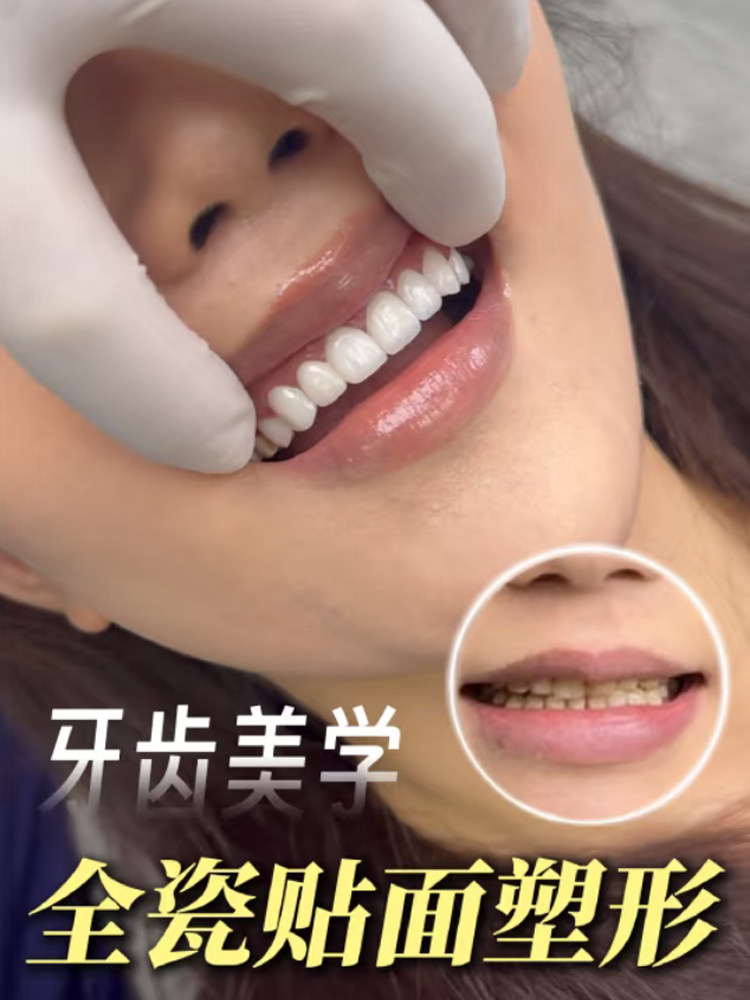 DO完牙，我居然想再拍一次婚纱照案例图片 1