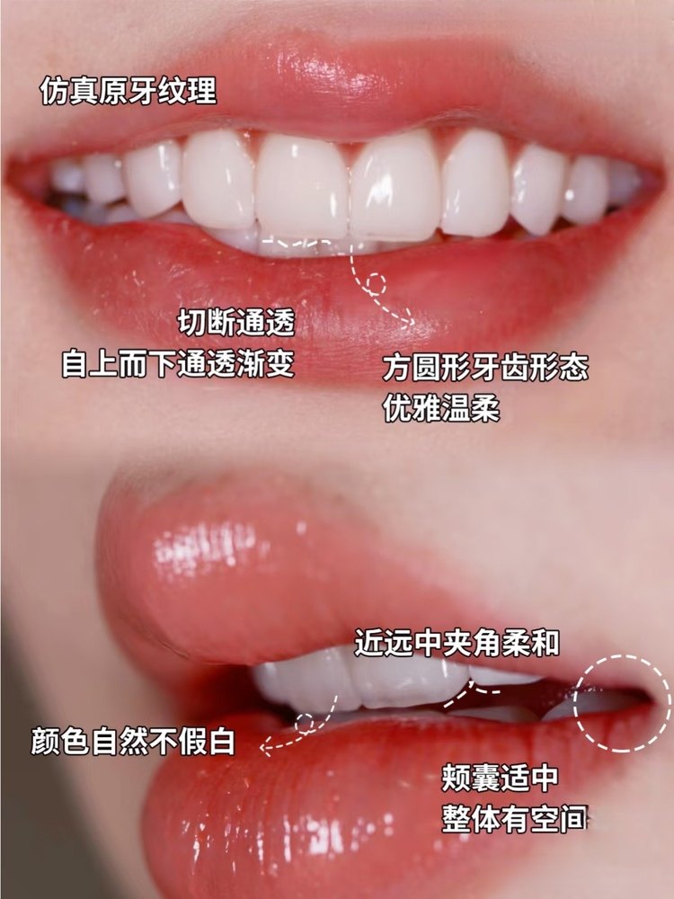 黄牙逆袭实录｜30分钟get女团同款发光齿！约会前急救神器被我挖到了！