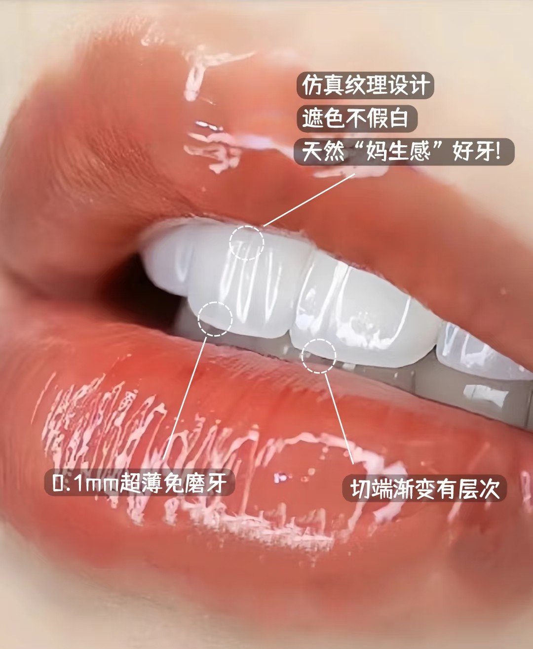 🌟【瞬间拥有明星同款微笑牙贴面】拯救大黄牙、缺损牙！💎