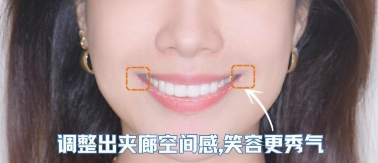 ✨32岁逆袭记：美学贴面+微笑线，我的笑容重生之路！