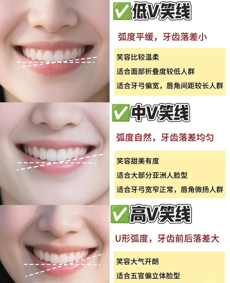 状态即风水｜笑容是最好的医美案例图片 2