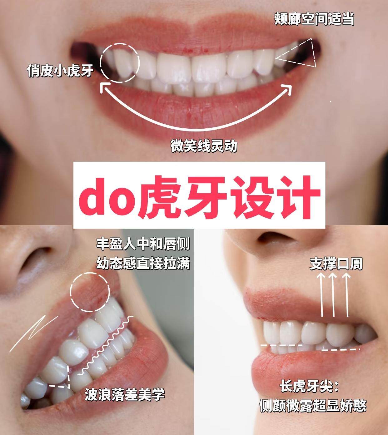 💯小虎牙设计分享｜我的可爱小心机🦷案例图片 2