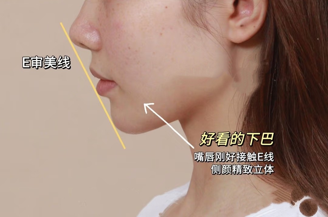 侧颜杀手？NO！嘴凸+后缩下巴自救指南💡