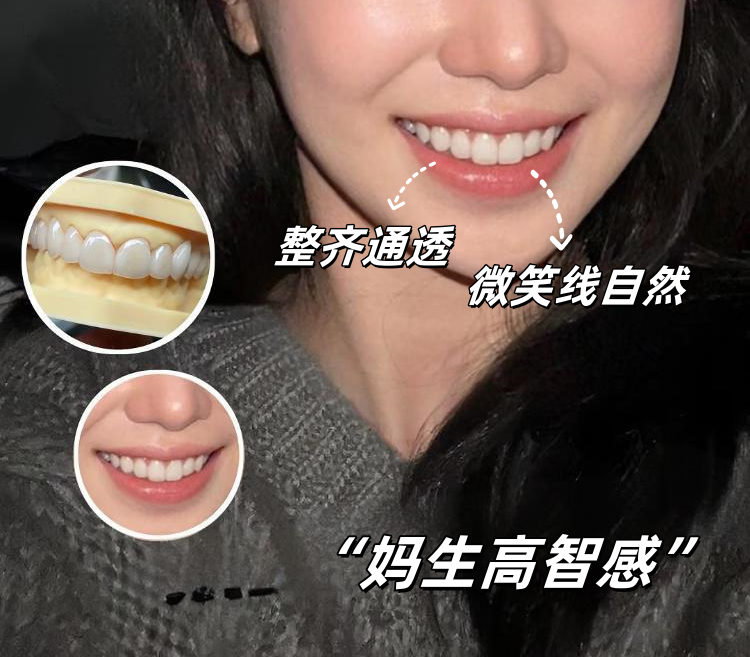 ✨25岁做牙贴面后，我悟了：真正的精致是取悦自己