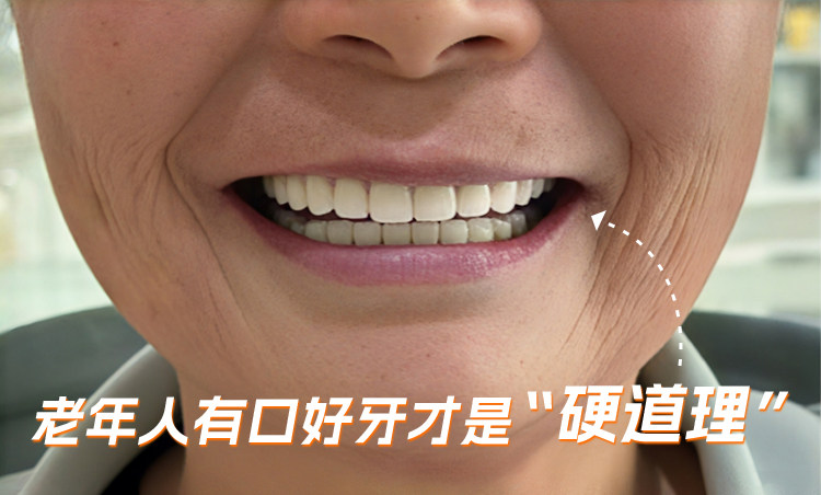 67岁爷爷全口种植牙记：重获新牙，吃嘛嘛香！案例图片 1