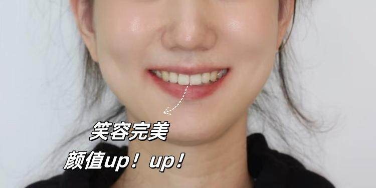 笑不活了！原来女明星的微笑线是这样练成的！