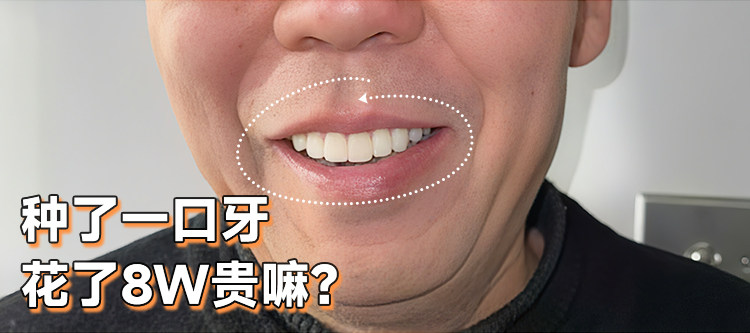 🦷从"铁齿铜牙"到"真香"的逆袭之路案例图片 1