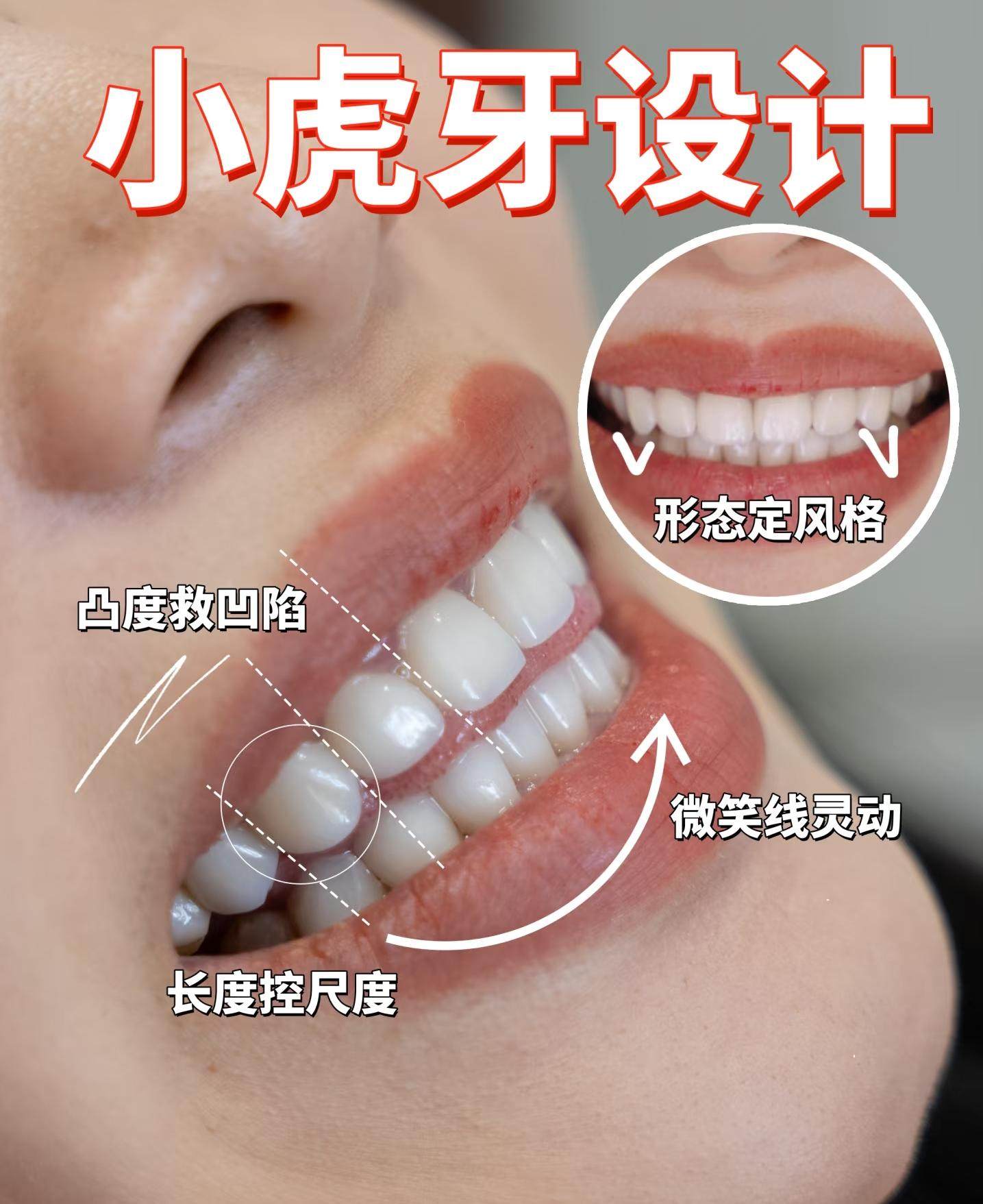 💯小虎牙设计分享｜我的可爱小心机🦷案例图片 1