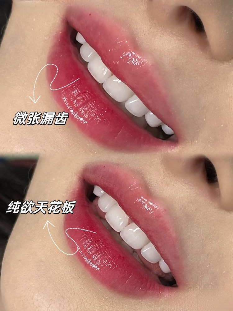 美牙真相｜别被"白牙焦虑"带偏了！牙齿抗衰才是终极目的案例图片 1