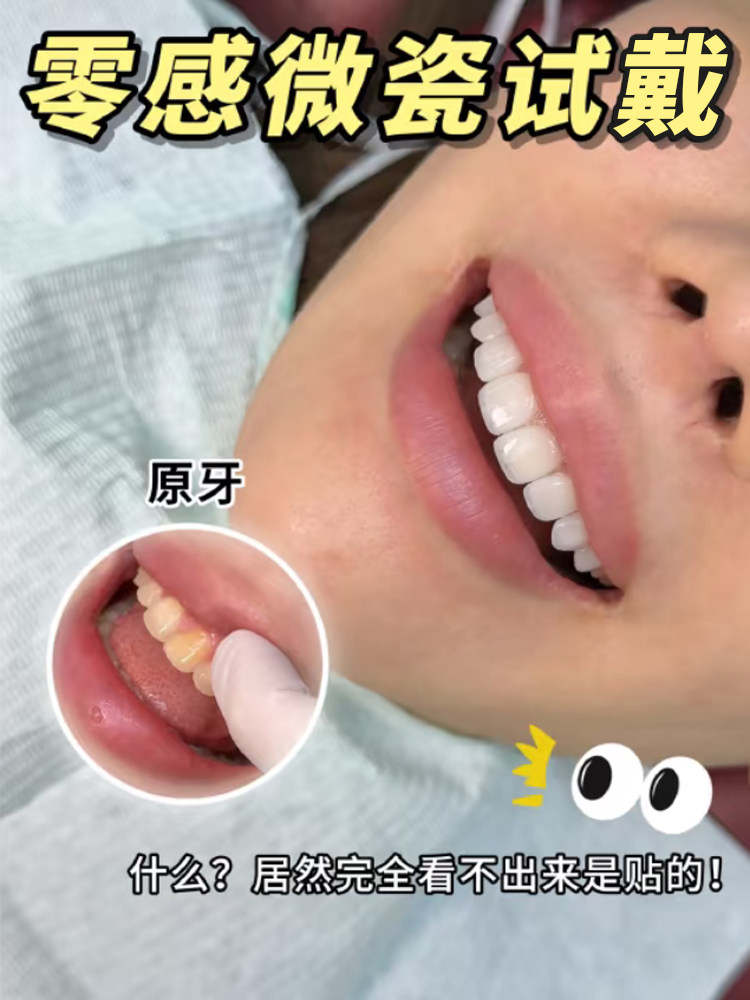 皮肤不白，牙齿来顶，笑容能抗起我的颜值嘛案例图片 1