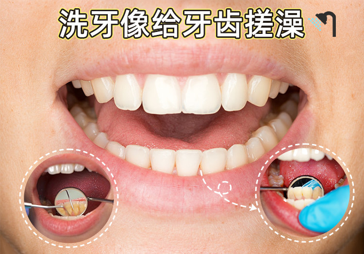 牙初体验｜给牙齿搓了个澡，清爽到飞起！✨