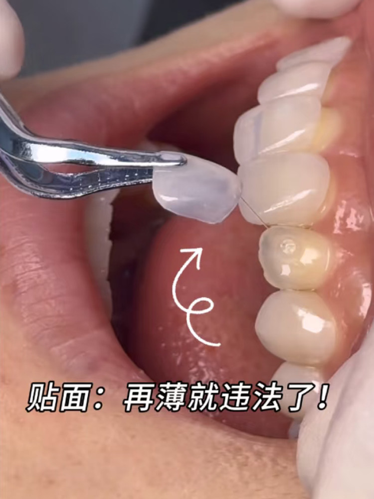 第一次看牙医，我居然不是因为蛀牙！案例图片 1