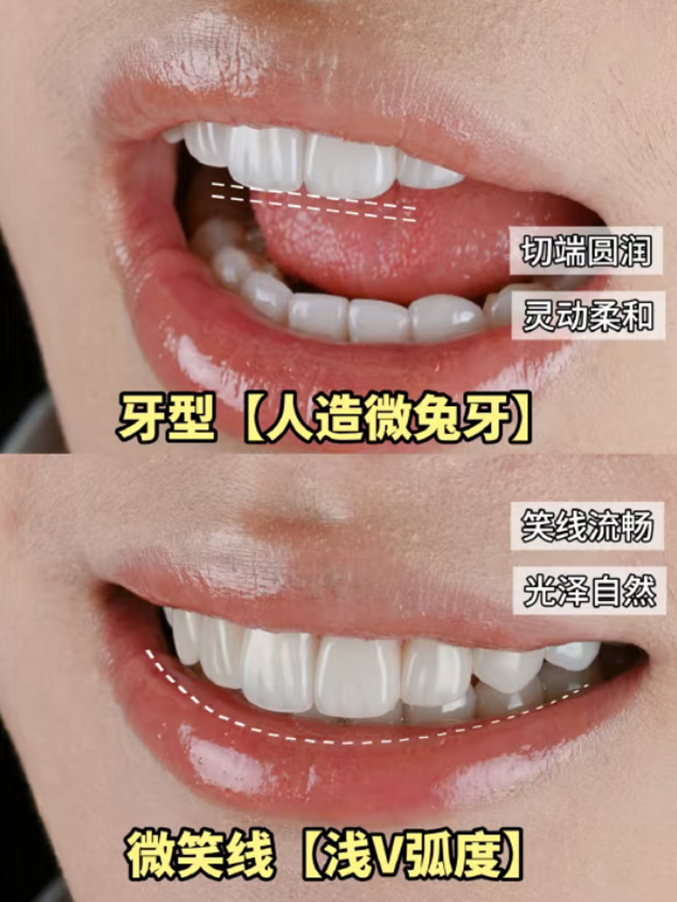 这波牙齿美白能给颜值加分嘛？案例图片 1