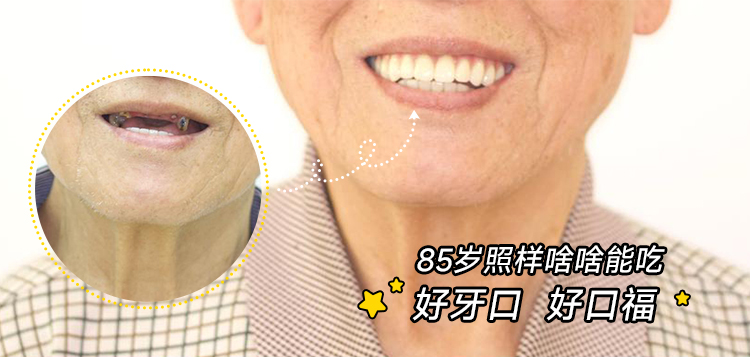 85岁爷爷的&ldquo;牙友&rdquo;秘诀：好牙口才是真福气！🦷✨