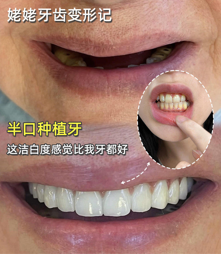 带70岁姥姥种牙后，她含着泪说了一句话，让我瞬间破防&hellip;