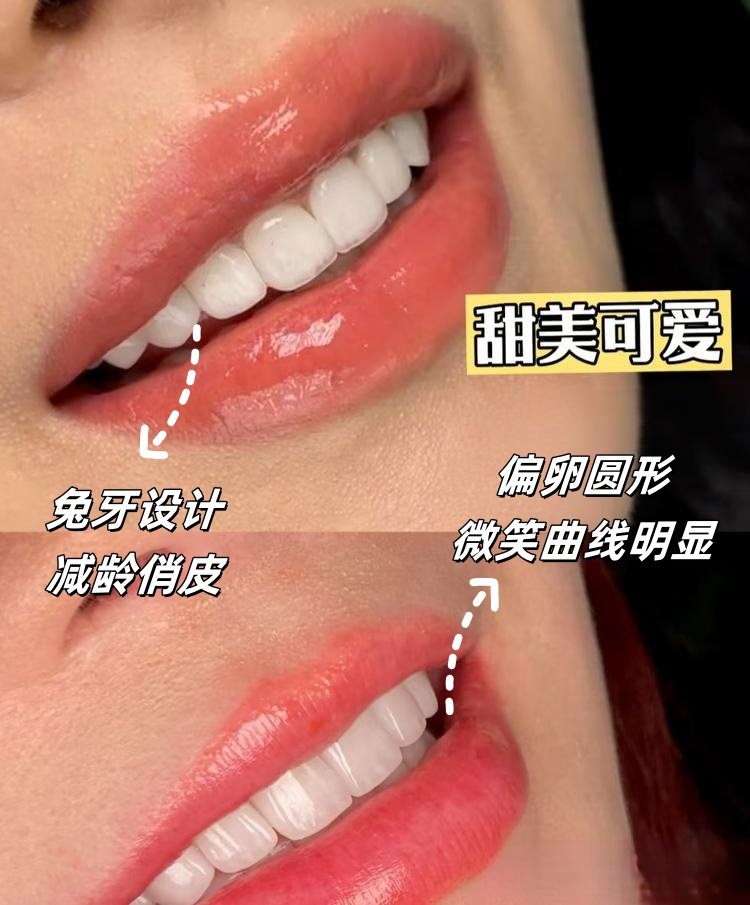兔牙女孩必看！选对类型秒变甜酷少女案例图片 1