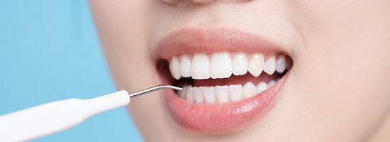 香港社区牙科支援计划详解：2025年新增洗牙、杜牙根服务资格如何申请及非政府组织服务点查询