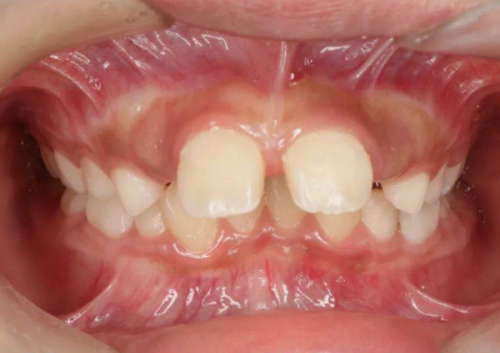 深圳千橙口腔诊所怎么样？专业评析与患者反馈全面解读