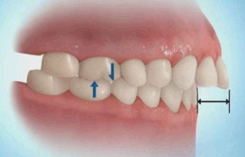 佛山顺德龙江牙美乐口腔门诊部怎么样？专业评析与患者反馈解析