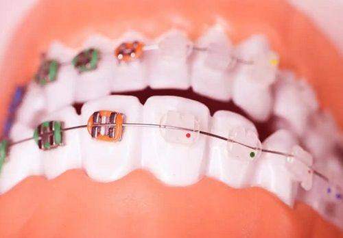 《营口团圆口腔医院怎么样？专业评估与患者反馈全面解析》