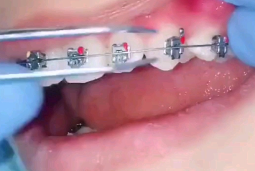 北京维乐口腔门诊部（方庄店）怎么样？专业评析与患者反馈全解析