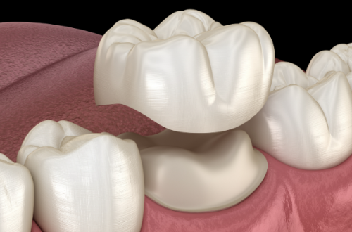 天津津领口腔怎么样,天津博凡口腔诊所怎么样？真实患者反馈大揭秘！