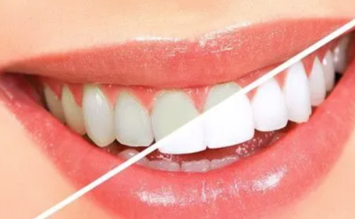 北京中科百年中老年口腔医院（西城院区）怎么样？专业医生与温馨服务助您安心就诊！