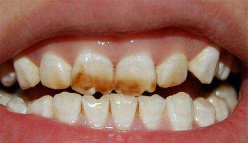 天津市南开医院口腔科怎么样,天津舒裕口腔怎么样？真实评价大揭秘！