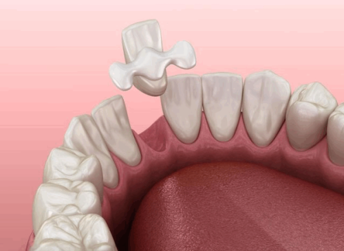 齿康达口腔医院怎么样？真实患者分享治疗体验与效果解析