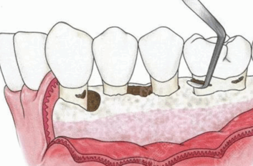 北京曙光振安口腔门诊部怎么样？专业医生与优质服务让你安心就诊！