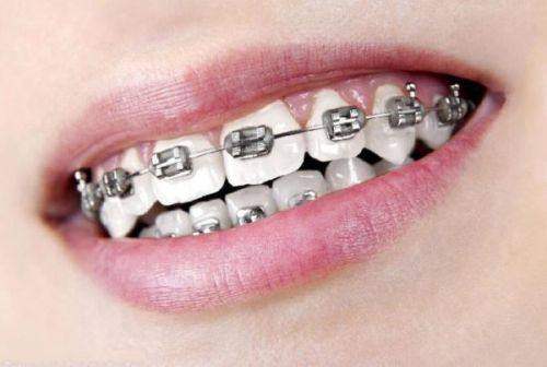 天津阳光树口腔（总院）怎么样？专业医生与优质服务让你放心就诊！