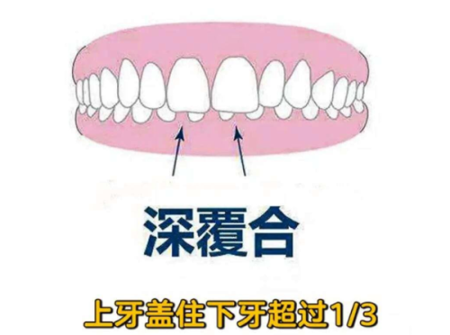 芽美口腔门诊部（东坝店）怎么样？专业服务与舒适环境让患者满意！