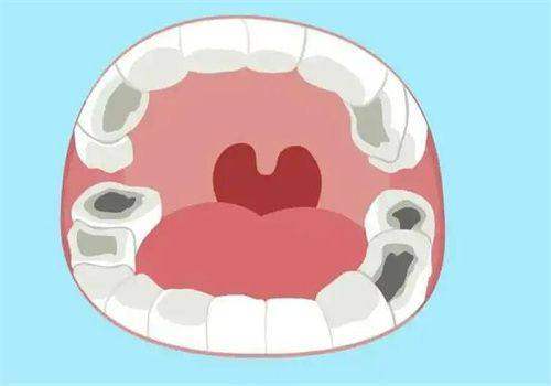 天津雅馨口腔门诊部怎么样,天津贝洁口腔诊所怎么样？真实患者分享使用体验！