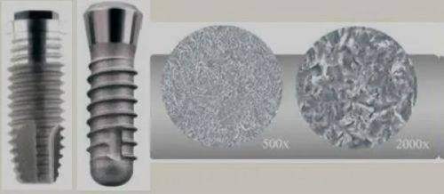 北京嘉信泽洋口腔诊所怎么样？真实患者分享就医体验与效果解析