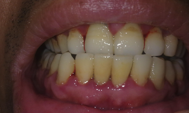 天津津乐口腔医院怎么样？专家推荐，服务优质，患者口碑良好！