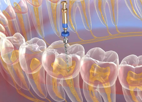 天津河西久美口腔怎么样？专业团队与优质服务让您放心就诊！