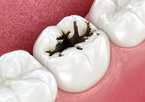 笑妍口腔门诊部怎么样？真实患者反馈与医疗服务一览！