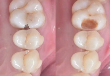 天津诺雅口腔门诊部怎么样,天津美奥口腔医院怎么样？真实患者分享体验与评价！