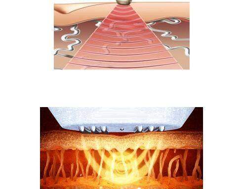 北京华臣医疗美容门诊部的服务体验