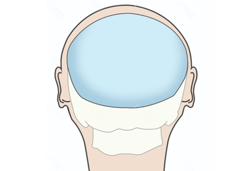 郑州曙光植发其他特色植发项目收费